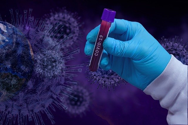 В Свердловской области выявлено 179 новых случаев COVID-19. + 1 в Шале